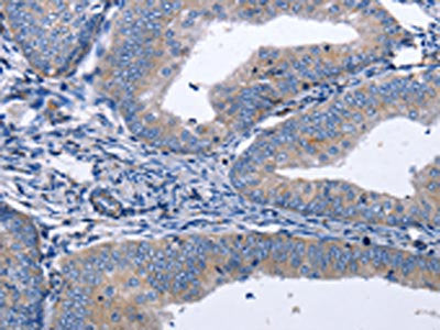 BDNF Antibody