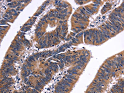 NFATC3 Antibody