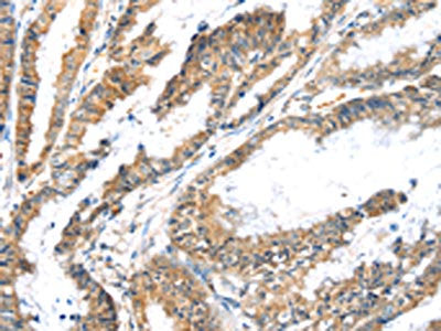 LZTS1 Antibody