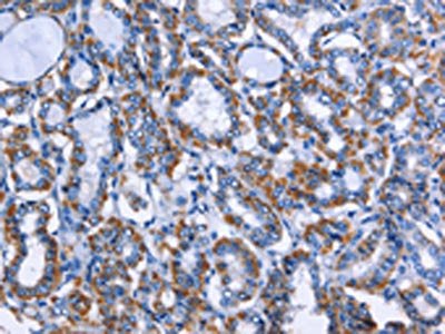 MPO Antibody