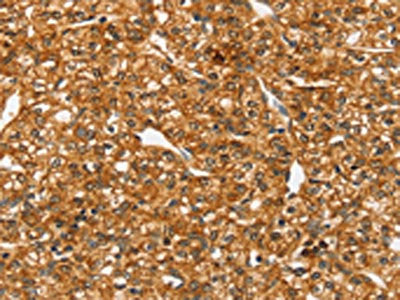SLC4A7 Antibody
