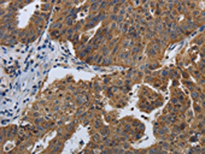 SPAG4 Antibody