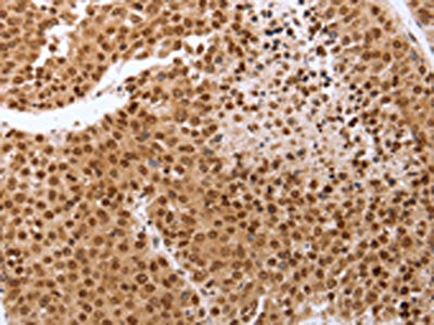 PTTG1 Antibody