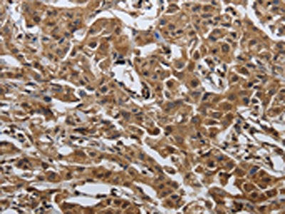 PDCD7 Antibody