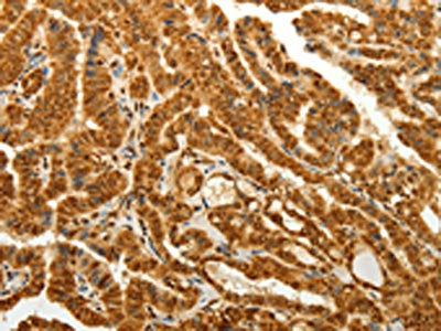 RAB26 Antibody