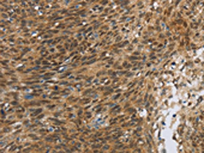 FOXB1 Antibody