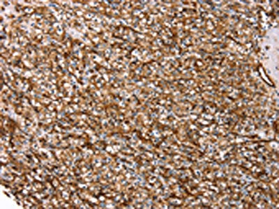AQP1 Antibody