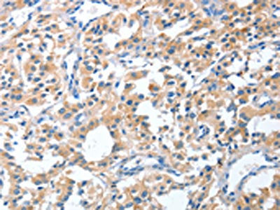 CGB Antibody