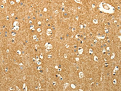 LPAR3 Antibody