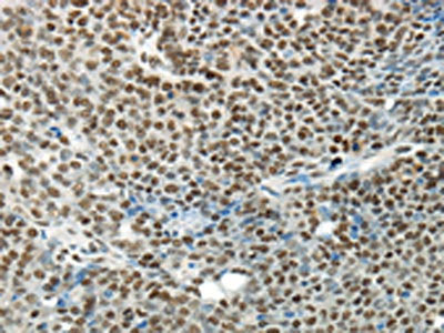 HNRNPM Antibody