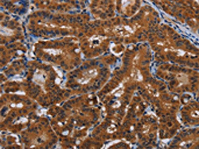 JMJD7 Antibody