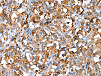 SNAI1 Antibody
