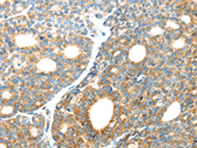 LEFTY2 Antibody
