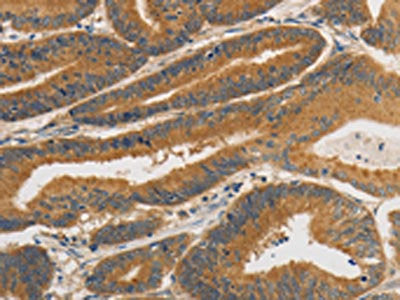 PRKD1 Antibody