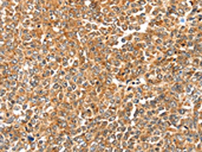 LOXL2 Antibody