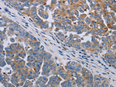 PARP10 Antibody