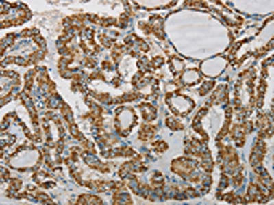 SDHB Antibody