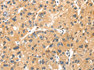 MAGEB2 Antibody