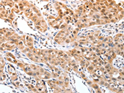 DPPA2 Antibody
