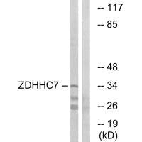 ZDHHC7 Antibody