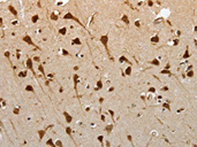 YBX1 Antibody
