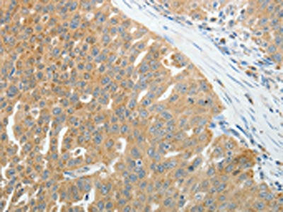 PRDX5 Antibody