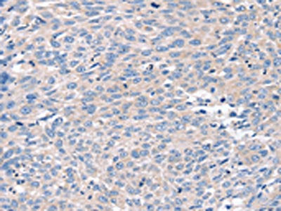 ROR1 Antibody