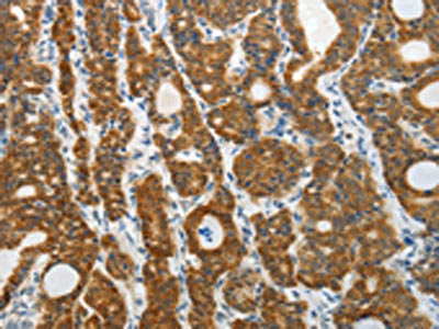 PRDX5 Antibody