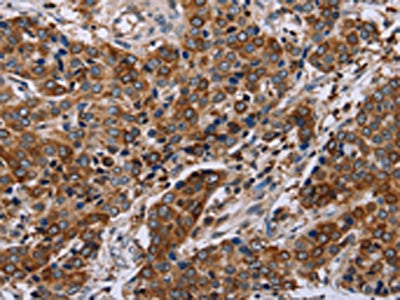 FAF1 Antibody