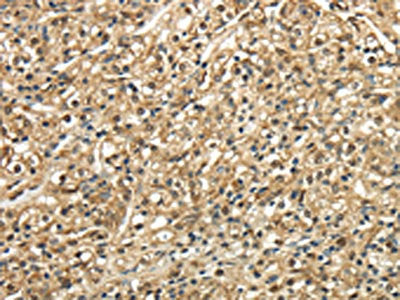 TSC22D1 Antibody