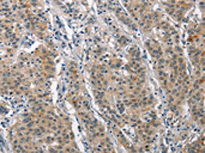 MAPT Antibody