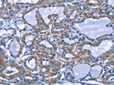 IFNG Antibody