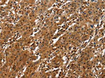 ATF4 Antibody