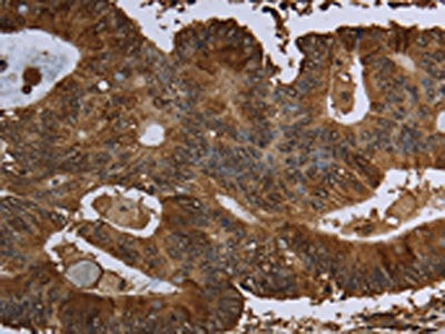 HPGD Antibody