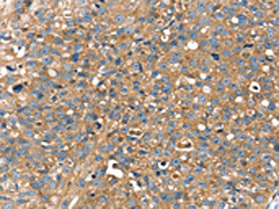 RAB9A Antibody