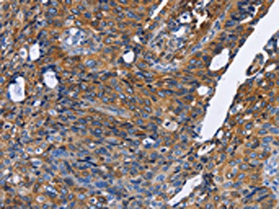 IFNG Antibody