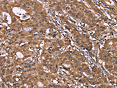 HLTF Antibody