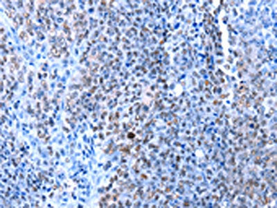 HMGB1 Antibody