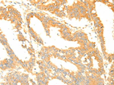 TERF1 Antibody