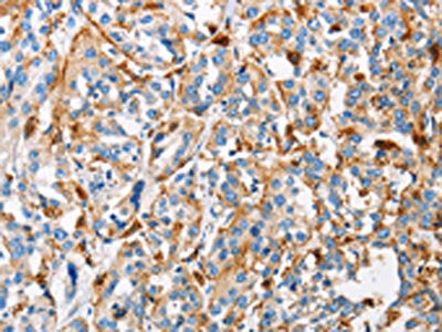 CTSL Antibody