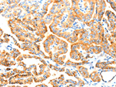 MANF Antibody