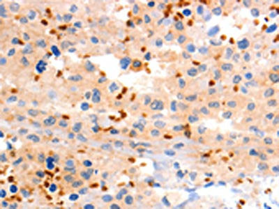 GRM8 Antibody