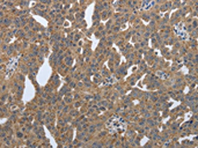 PDIA2 Antibody