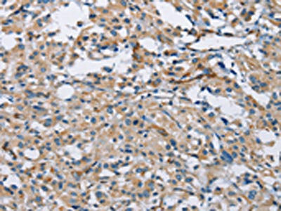 PTK6 Antibody