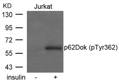 Phospho-DOK1 (Tyr362) Antibody
