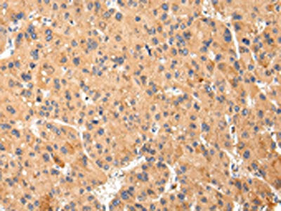 ABCC1 Antibody