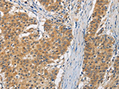 FASTK Antibody