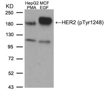 Phospho-ERBB2 (Tyr1248) Antibody