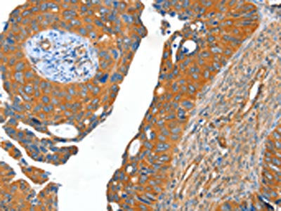 ACOT11 Antibody