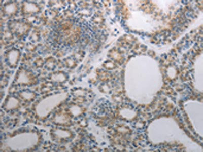 RBMS3 Antibody